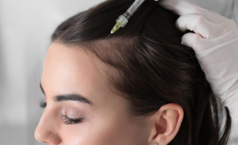 female hair transplant in UK