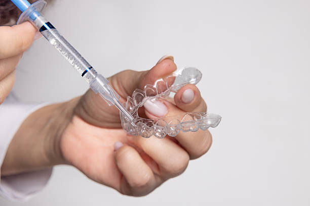 Teeth Whitening in Riyadh