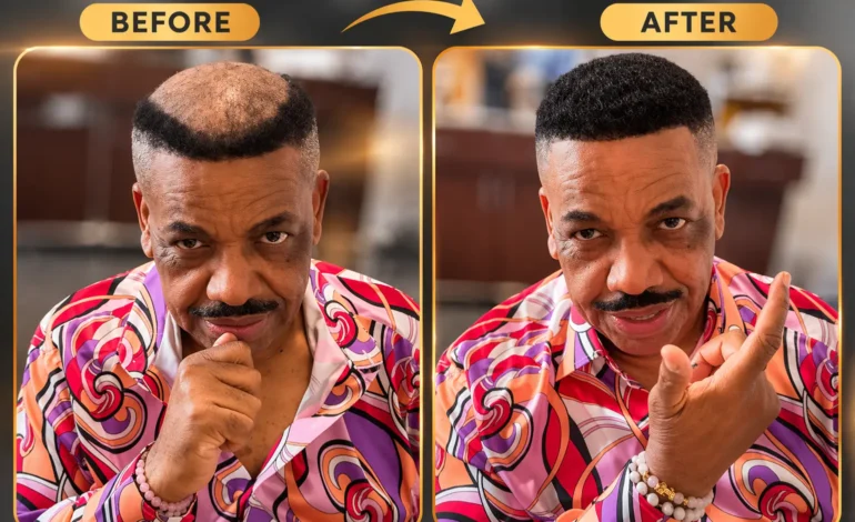 After-Before-Result