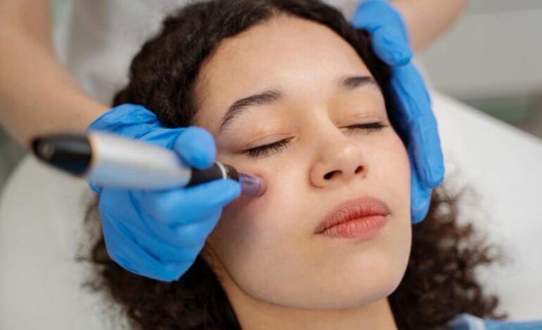 Lip Flip Behandlung: Moderne Lippenästhetik im Überblick