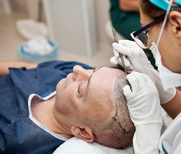 زراعة الشعر في دبي لاستعادة خط الشعر الطبيعي مع تقدم العمر