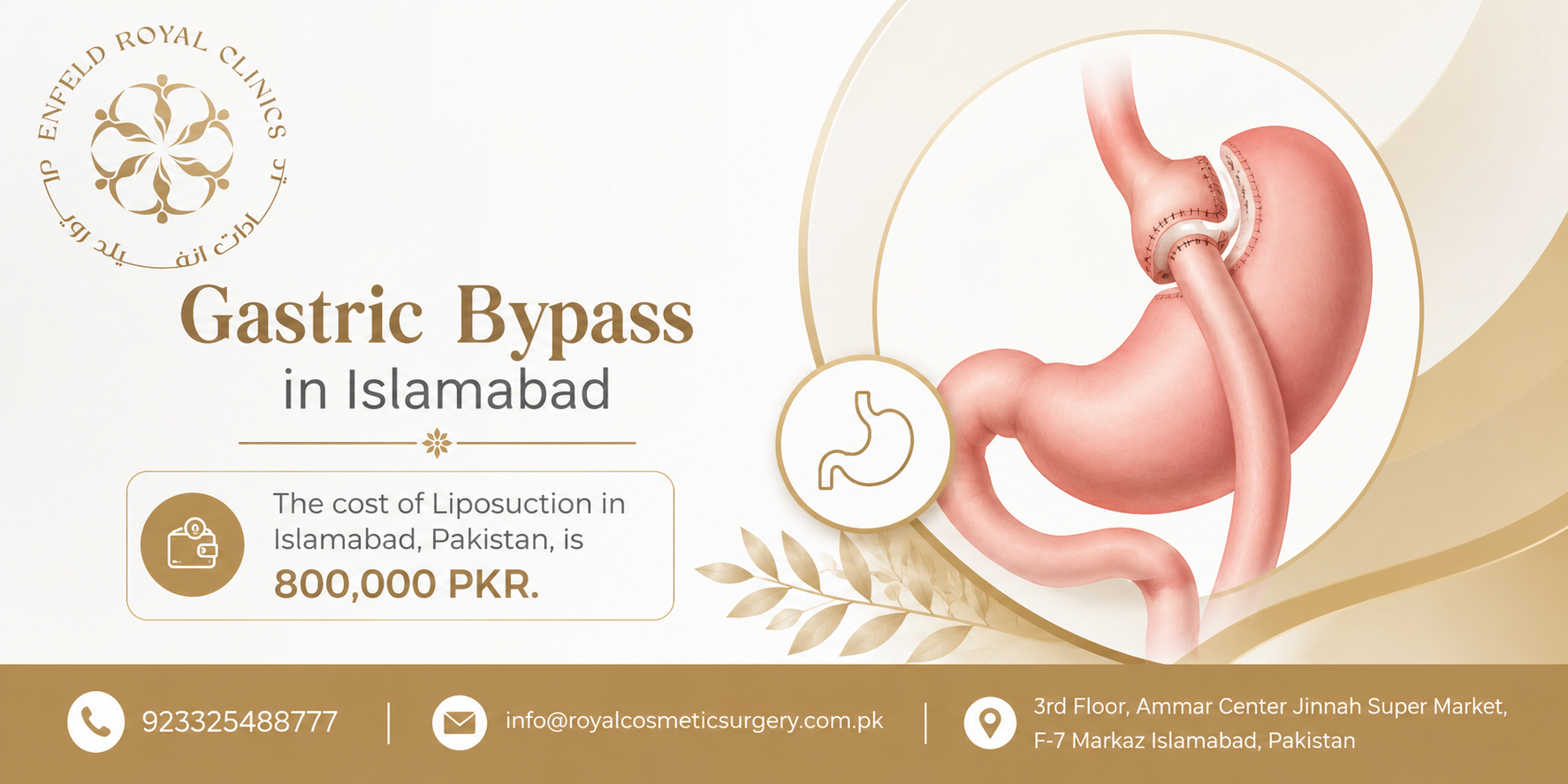 Gastric Bypass Recovery Success