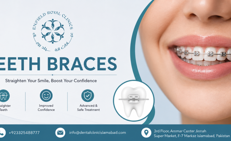 Teeth Braces in Islamabad