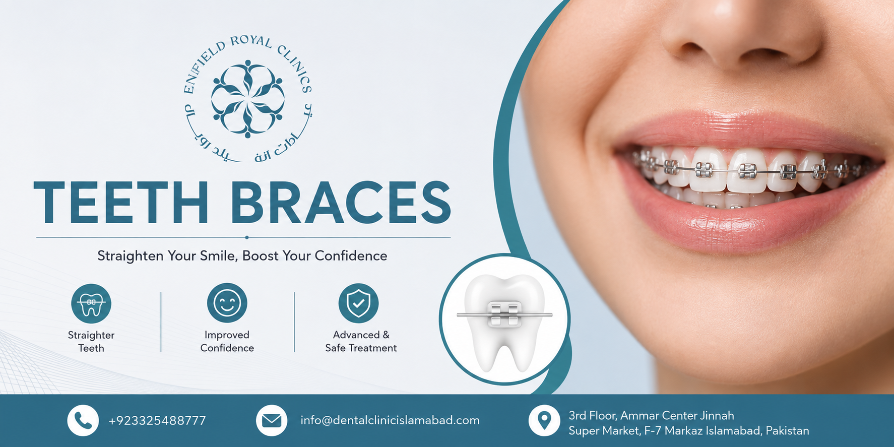 Enhance Your Appearance with Teeth Braces in Islamabad