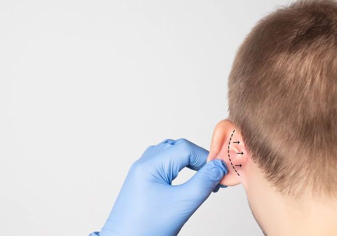 A plastic surgeon doctor examines a male patient s ear for an otoplasty operation. The concept of removing deafness, copy space