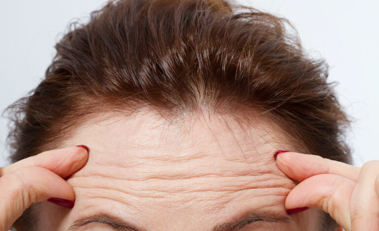 Does Fine Lines and Wrinkle Removal Improve Skin Texture