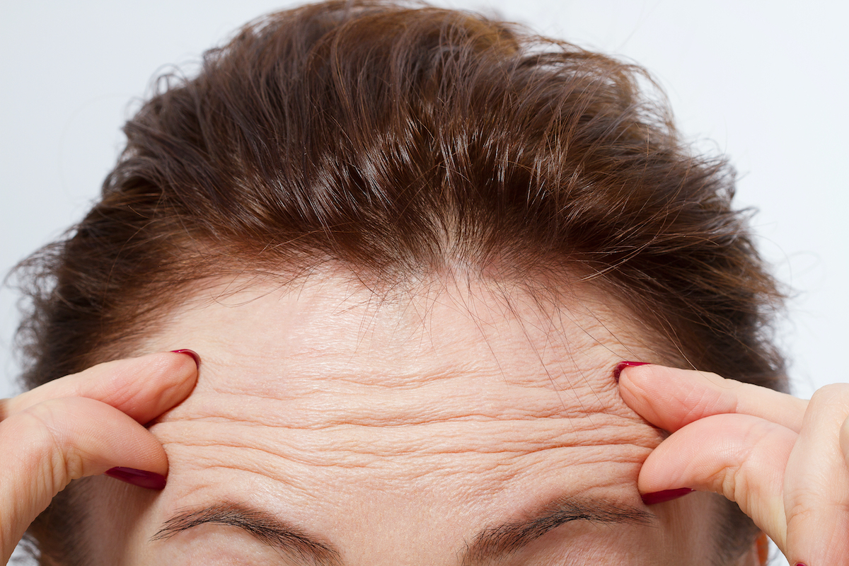 Does Fine Lines and Wrinkle Removal Improve Skin Texture