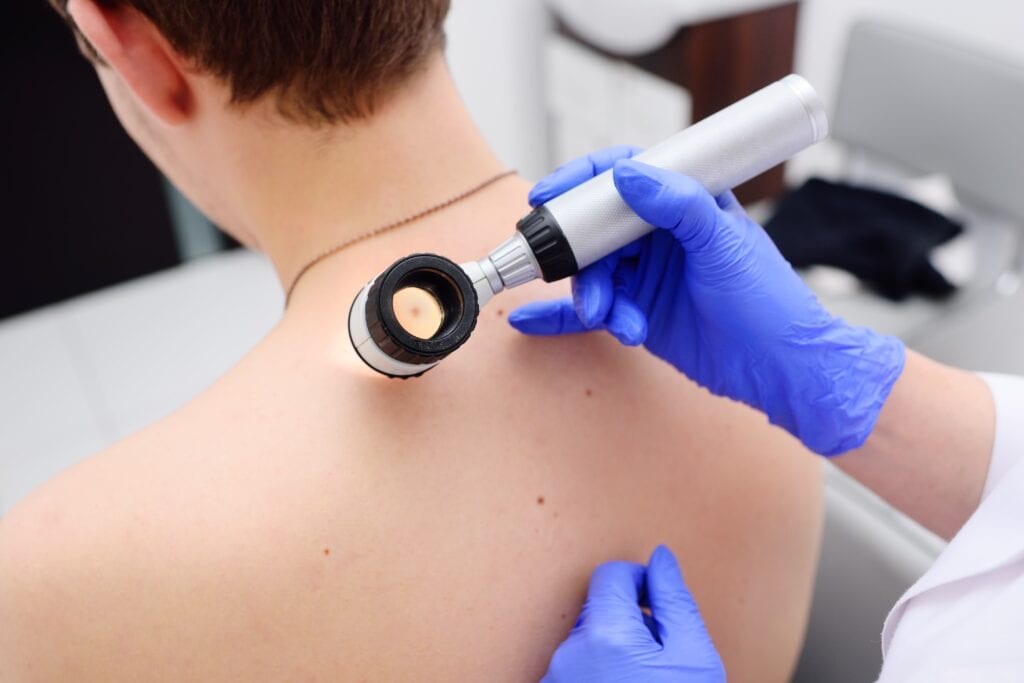 How Can Dermoscopy Mole Evaluation Monitor Moles