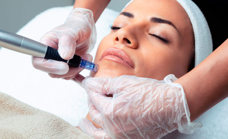 Is Dermapen Treatment Good for Uneven Skin