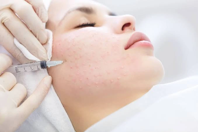 Is Skin Booster Injection Suitable for Fine Lines