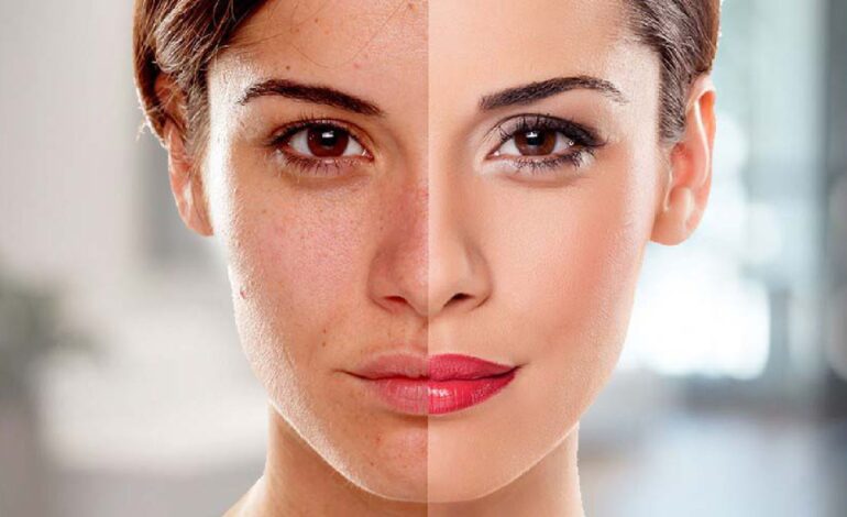 Is Skin Booster Injection Suitable for All Skin?